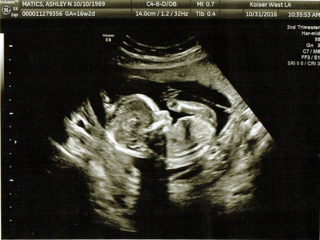 10-31-16-16w2d-baby-b